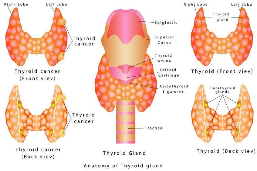 Thyroid Disease Illustration