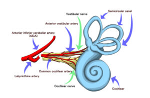 Vertigo Diagram