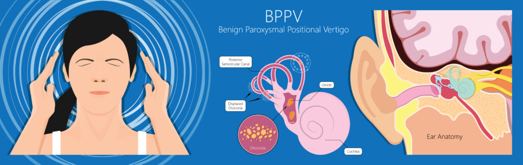 Is Vertigo a Permanent Condition? - Chicago ENT