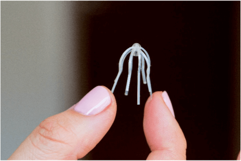 SINUVA implant to scale